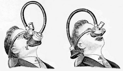 picture of a apparatus nitrous oxide circa 1925