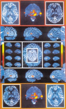 brain images